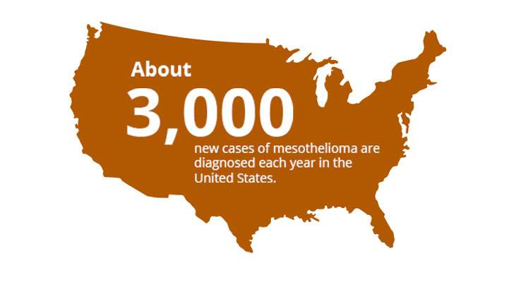 Mesothelioma Diagnosed in USA