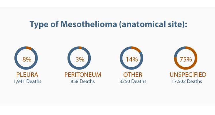 Types of Mesothelioma