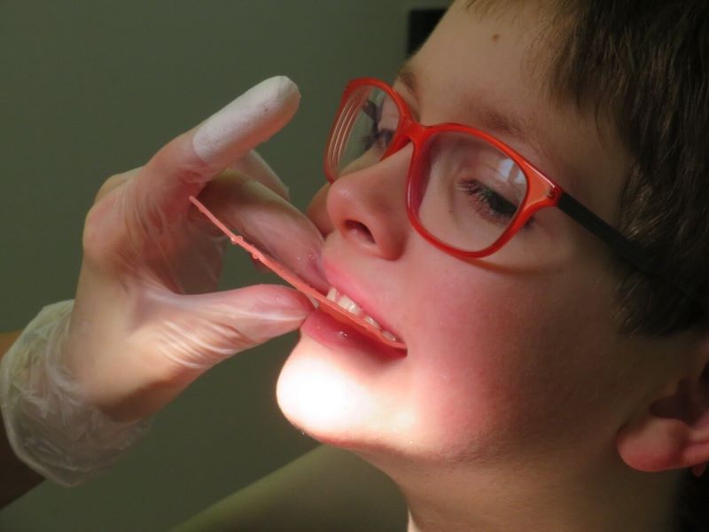 child-dentist-denture